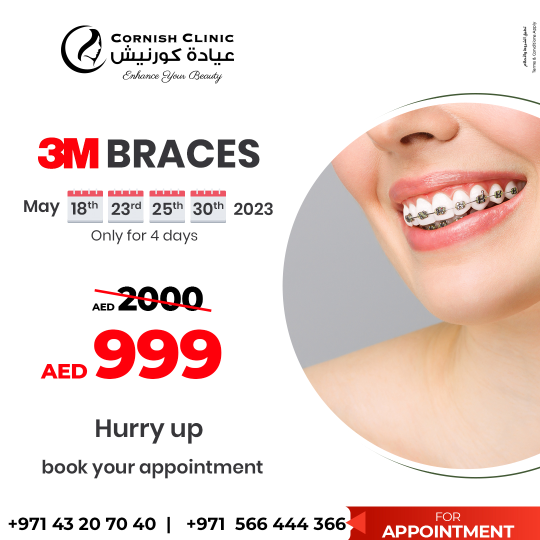 3M Braces offer